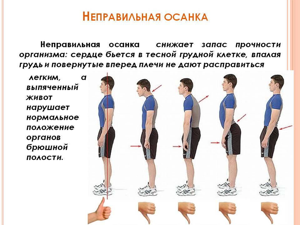 Следим за осанкой